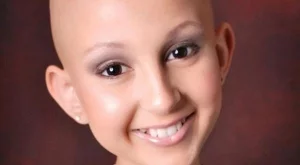 Вдъхновяващото! Момиче болно от рак рекламира кoзметика
