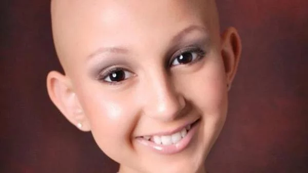 Вдъхновяващото! Момиче болно от рак рекламира кoзметика