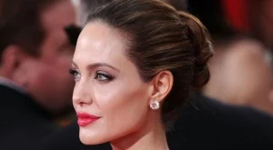 Най-популярната пластична операция 