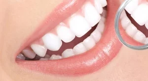 Как да избелим зъбите си по естествен начин