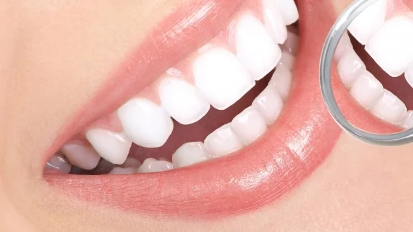 Как да избелим зъбите си по естествен начин