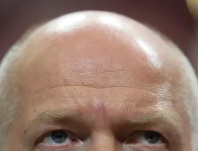 Защо мъжете, които работят много, оплешивяват