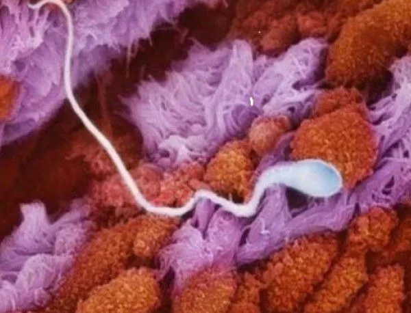 Френски учени създадоха сперматозоиди в лабораторни условия