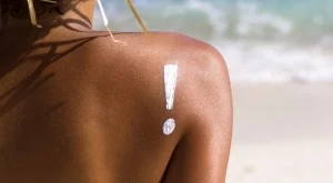 Природни лекове срещу летните "мъчения"