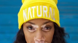 Шантел Браун - уникален модел с рядко кожно заболяване