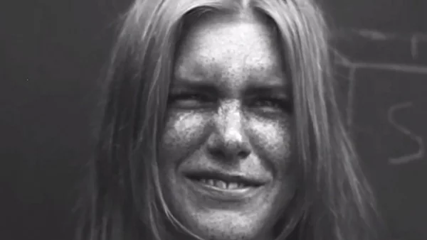 Вижте какво прави слънцето с кожата ви