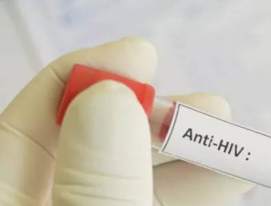 РЗИ – Шумен организира безплатно и анонимно изследване за ХИВ/СПИН