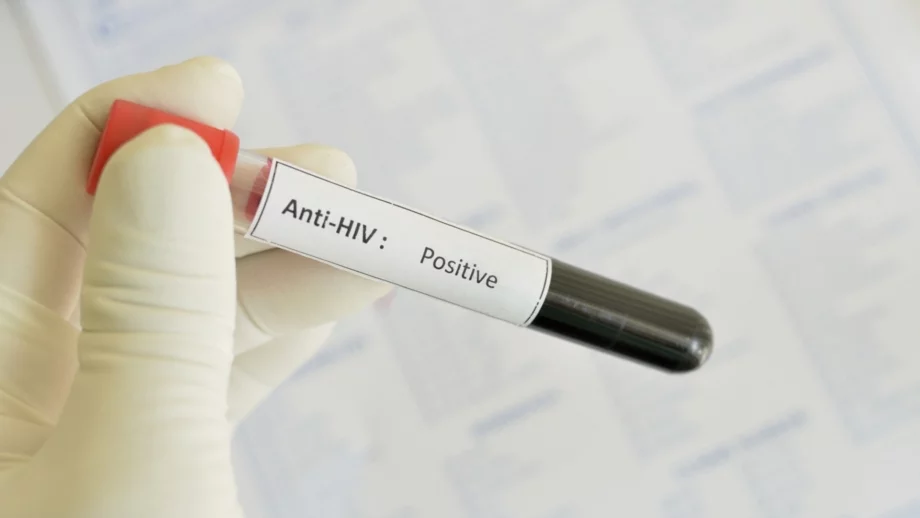 МЗ съобщи, че са осигурени необходимите лекарства за пациенти с ХИВ