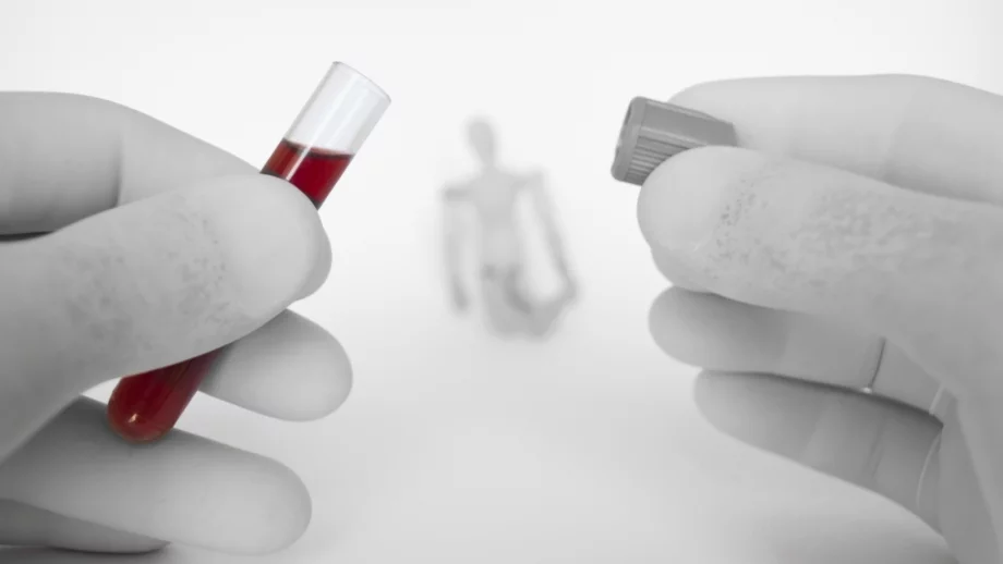 Намаляват смъртните случаи вследствие на СПИН