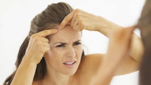 Направете това, ако имате акне и суха кожа