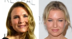 Рене Зелуегър е неузнаваема