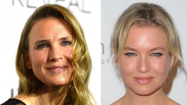 Рене Зелуегър е неузнаваема