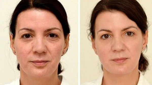 Какво се случва, когато пиете по 3 л вода на ден