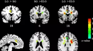 Учени установиха как излишните килограми влияят на мозъка ни
