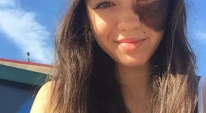 Да обичаш своя дефект