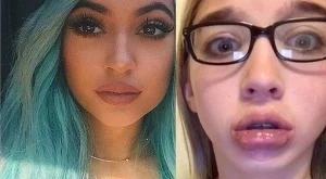 Нова мания - тийнове си правят като устните на Кайли Дженър