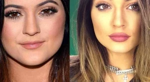 Кайли Дженър най-после призна за устните си