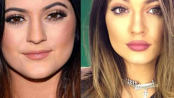 Кайли Дженър най-после призна за устните си