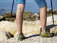 Пазете краката си здрави: 5 мита за разширените вени