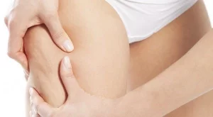 Антицелулитен масаж в домашни условия