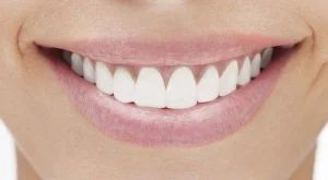 3 натурални метода за избелване на зъби