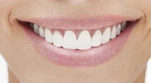 6 съвета за холивудска усмивка