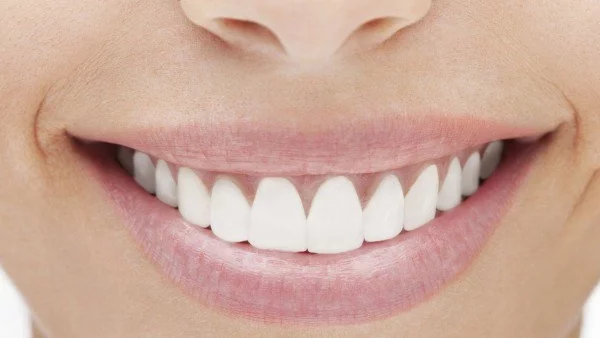 6 съвета за холивудска усмивка