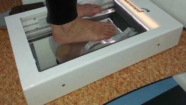 Безплатни прегледи на ходилата