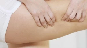 5 упражнения срещу целулит