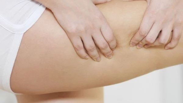 5 упражнения срещу целулит