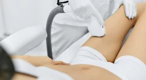 Кратък наръчник за лазерна епилация 