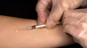 Японски учен с хипотеза за ниската смъртност от COVID-19 в Азия, включваща и БЦЖ 