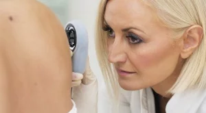 Безплатни прегледи за рак на кожата