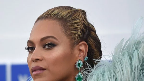 Звезди, които са приели своите недостатъци