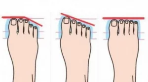 Какво казва за нас формата на пръстите на краката ни?