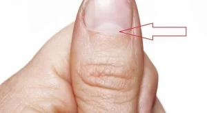 Какво издава полукръга в ноктите