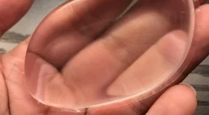 Не това не е имплант за гърди, а...