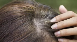 5 начина как да прикрием белите косми