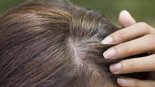 5 начина как да прикрием белите косми