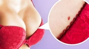 Какво означава това червено петно върху кожата ви