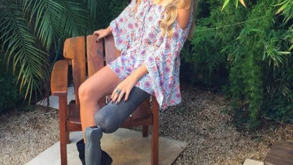 Момиче с ампутиран крак вдъхновява с усмивката си