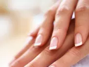 Лекар предупреждава: Черните ивици по ноктите може да са признак за следния проблем