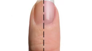 Причини за пожълтяване на ноктите 