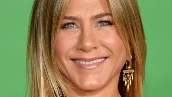 5 известни жени, които не крият недостатъците си (снимки)