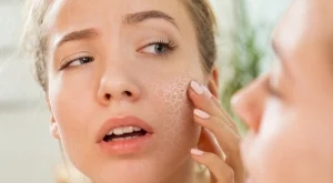 Бърз трик за справяне със суха и люспеща се кожа