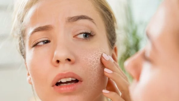 Бърз трик за справяне със суха и люспеща се кожа