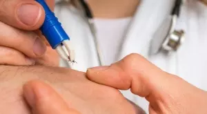 Всичко, което трябва да знаете за кърлежите този сезон