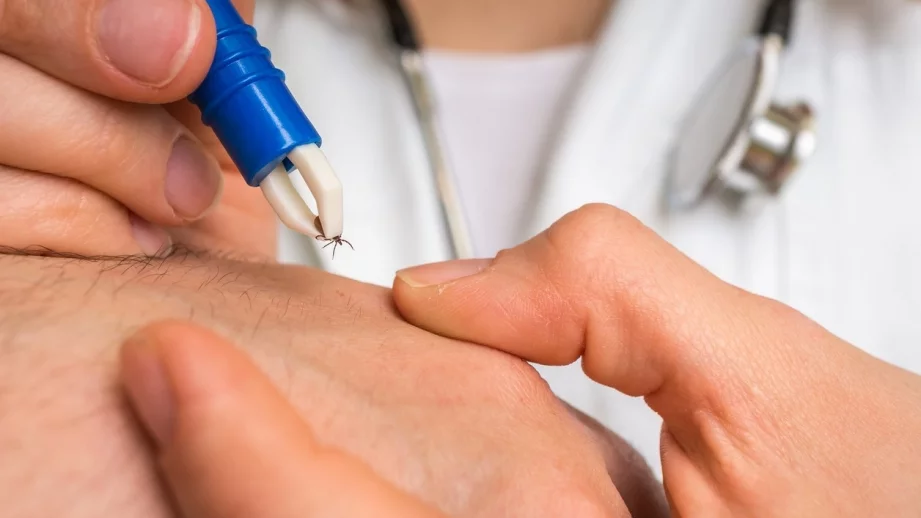 Повече от 20% от кърлежите у нас са заразени с лаймска болест 