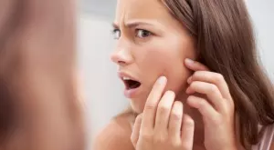 Най-честите причини за появата на акне