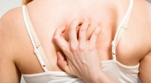 Навици, които предотвратяват появата на акне по тялото